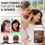 Dr Berg Hair Formula Vitamins for Men & Women, Includes Biotin, Saw Palmetto, & Horsetail, Hair Supplement for Hair Loss 90 Veg Capsules