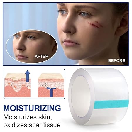 aliver Clear Silicone scar Sheets For Face & Body