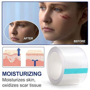 aliver Clear Silicone scar Sheets For Face & Body