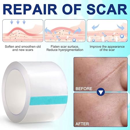 aliver Clear Silicone scar Sheets For Face & Body