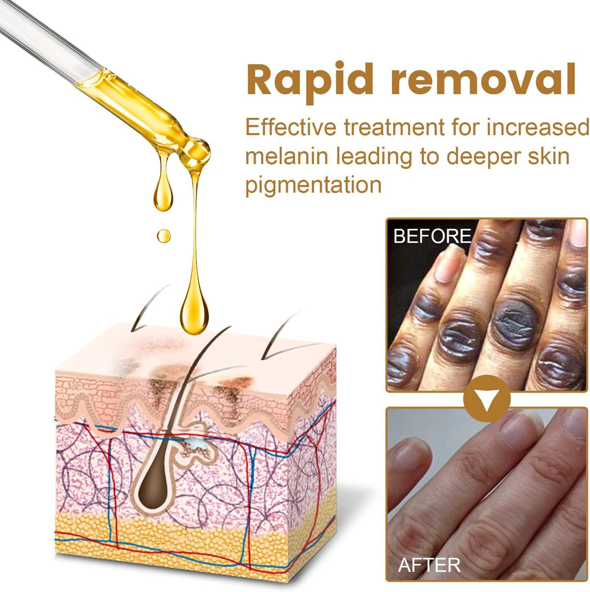 Jaysuing Therapy Drops Lighten Dark patches 10ml
