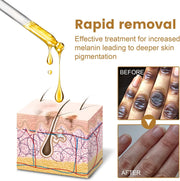 Jaysuing Therapy Drops Lighten Dark patches 10ml