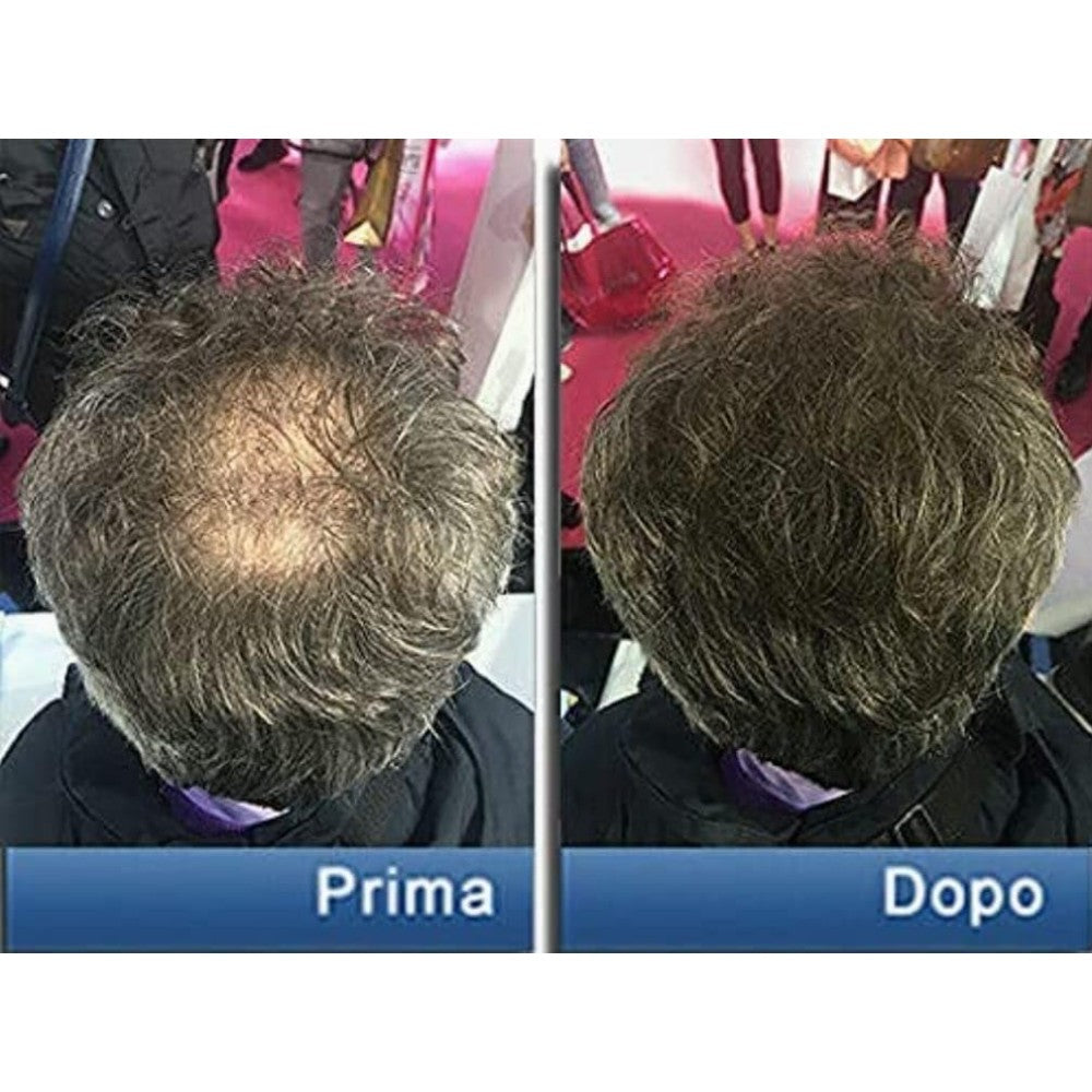 Pantogar Specific Treatment For Hair and Nails To Help Reduce Hair Loss, Improve Thickness and Shine, and Combat Brittle Nails 90 Caps
