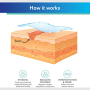 ScarAway Silicone Scar Gel For the Treatment of Scars & Post-surgical marks 20g